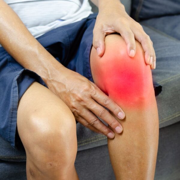an inflamed knee